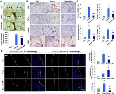 Force-Induced Autophagy in Periodontal Ligament Stem Cells Modulates M1 Macrophage Polarization via AKT Signaling